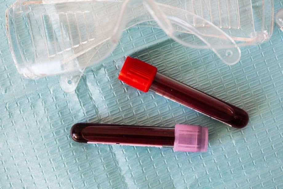 Top 7 Reasons to Book a CBC Blood Test in Dubai Today.