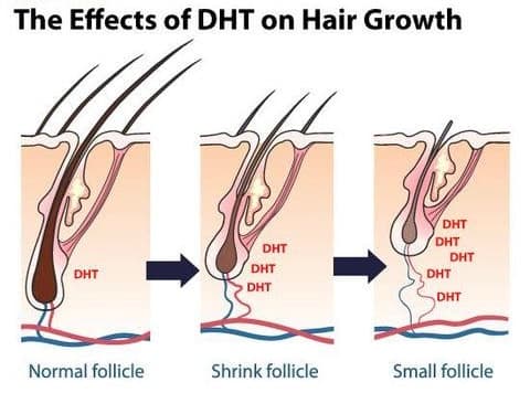 How Fin@steride for hair works?