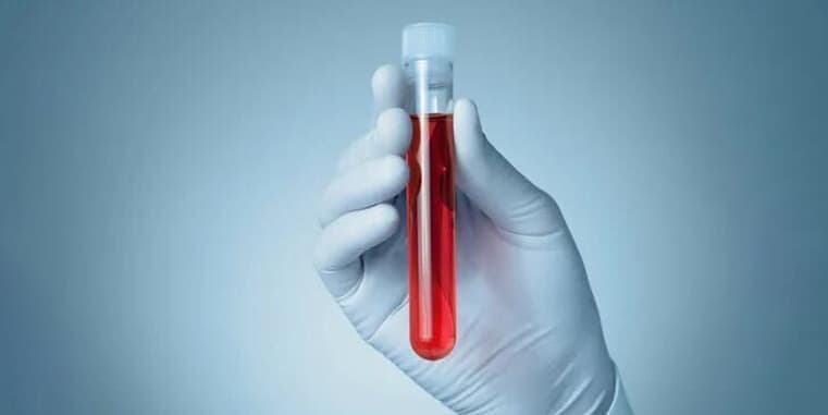 Ajman At-Home Blood Tests